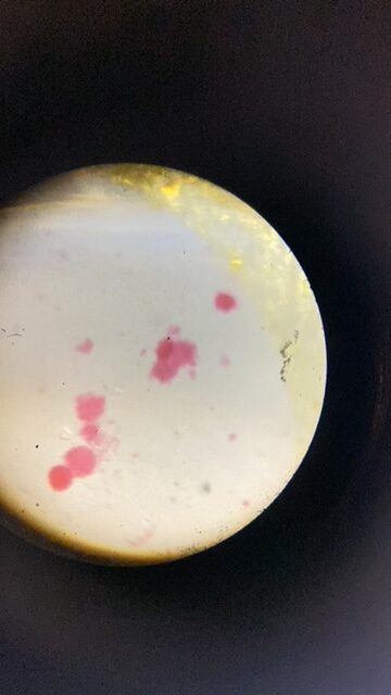 Amoeba Protozoa W.M Slides (Pk. of 5Pcs.)