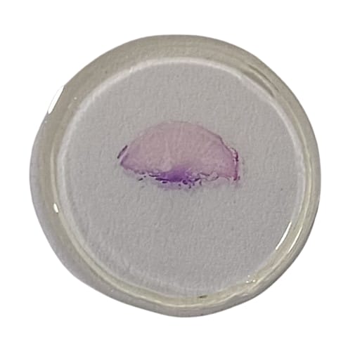 Nerve Cell T.S Slides Set of 5 With Plastic Box