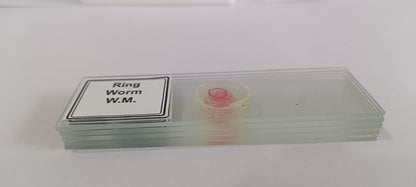 Ringworm Prepared Microscope Slide Set (Set Of 5Pcs.)