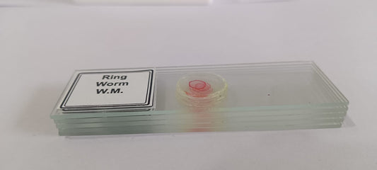 Ringworm Prepared Microscope Slide Set (Set Of 5Pcs.)