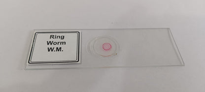 Ringworm Prepared Microscope Slide Set (Set Of 5Pcs.)