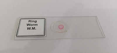 Ringworm Prepared Microscope Slide