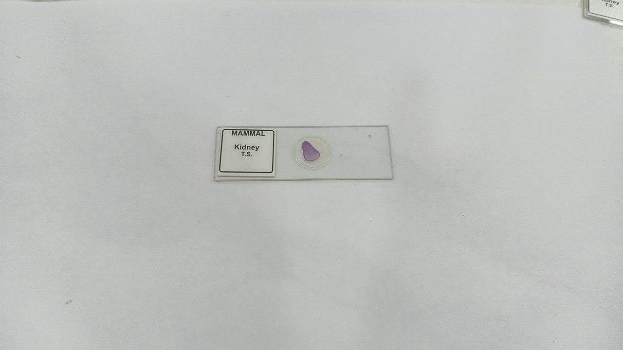 Mammal Kidney T.S (Set of 5 Pcs.) with Box