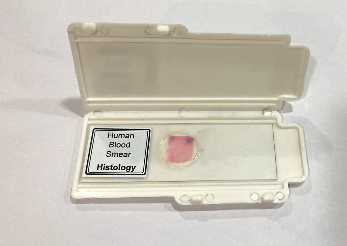 Human Blood Smear
