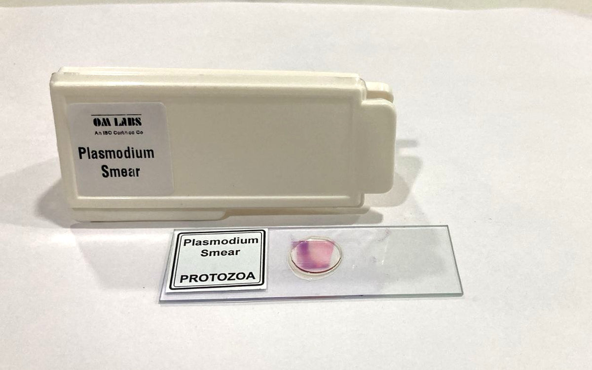 Plasmodium Smear (PROTOZOA)