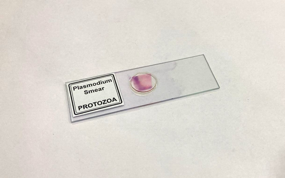 Plasmodium Smear (PROTOZOA)