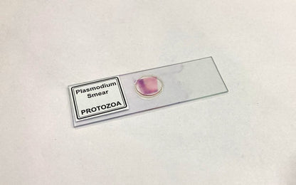 Plasmodium Smear (PROTOZOA)