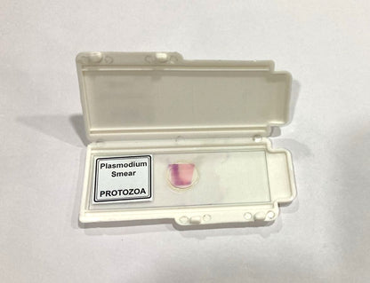 Plasmodium Smear (PROTOZOA)
