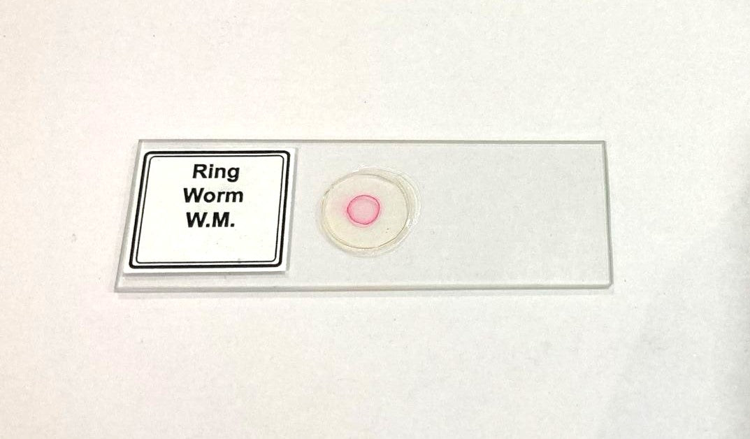 Ringworm Prepared Microscope Slide