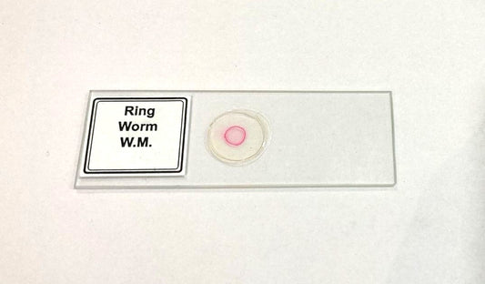 Ringworm Prepared Microscope Slide