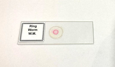 Ringworm Prepared Microscope Slide