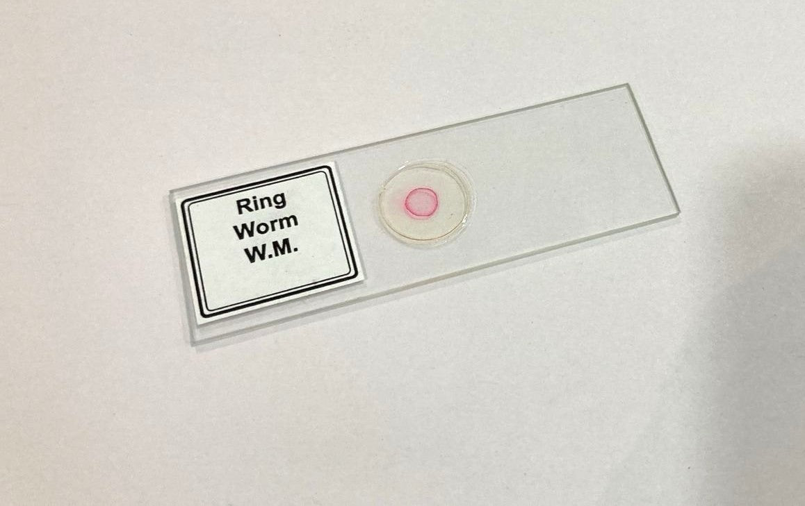 Ringworm Prepared Microscope Slide
