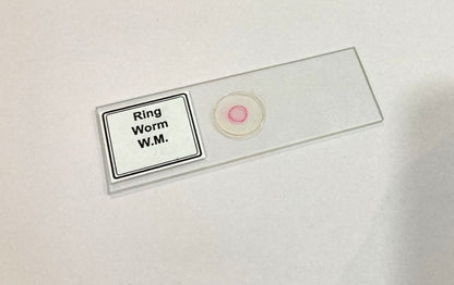 Ringworm Prepared Microscope Slide