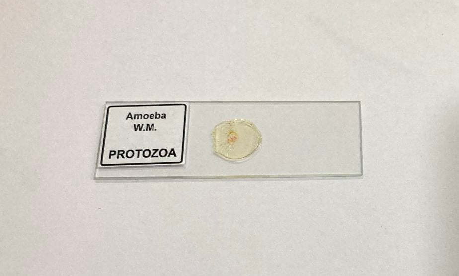 Amoeba Protozoa W.M Slides