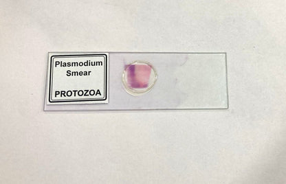 Plasmodium Smear (PROTOZOA)