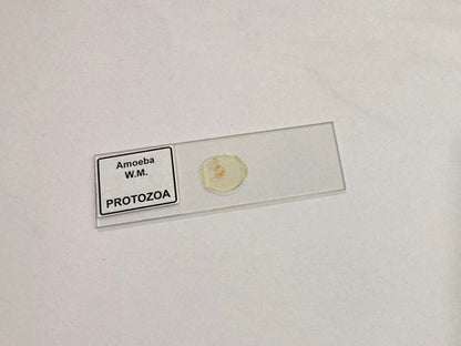 Amoeba Protozoa W.M Slides