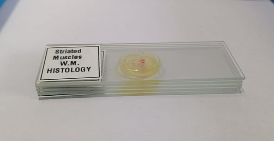Striated Muscle Prepared Microscope Slide Set Of 5 Pcs. With Plastic Box